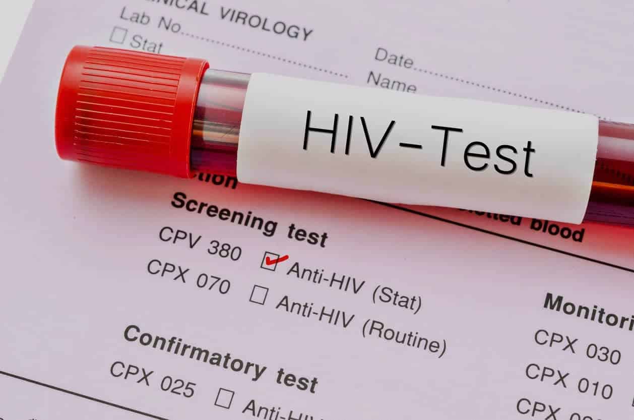 Apa Itu Test HIV?