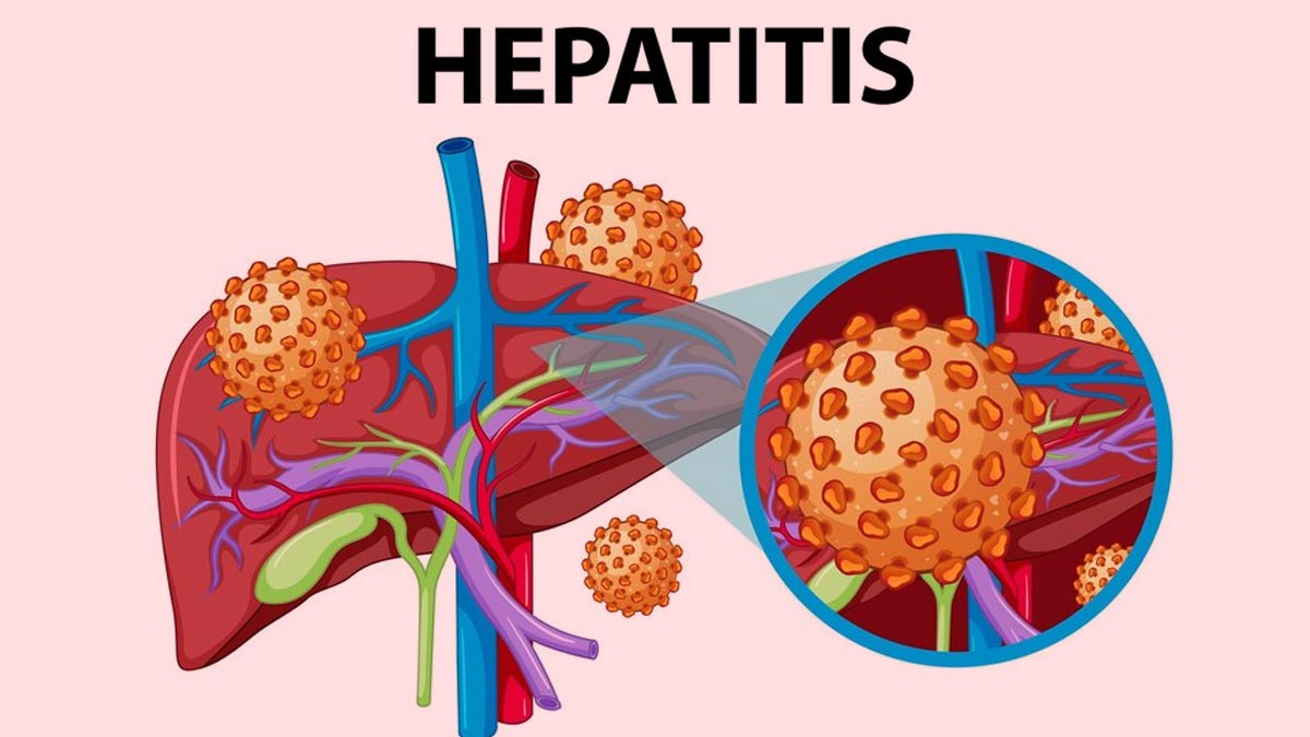 Pekan Peduli Hepatitis B