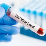 Tes Viral Load dan Metodenya